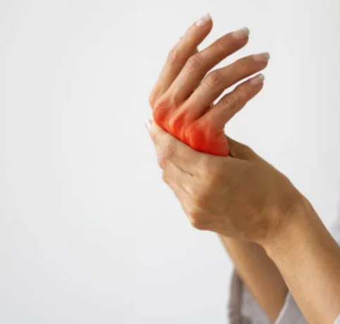 Rheumatology Photo