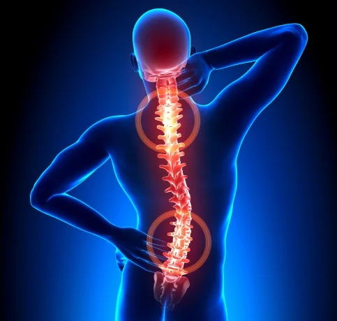Spine Surgery Photo
