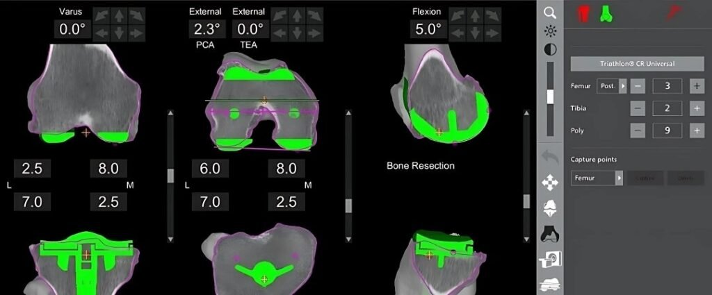 CT Scan