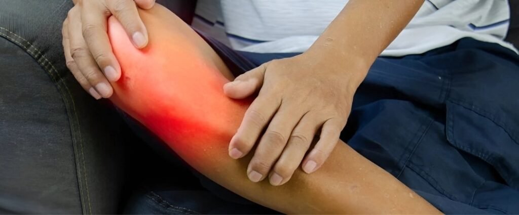 Knee Injury