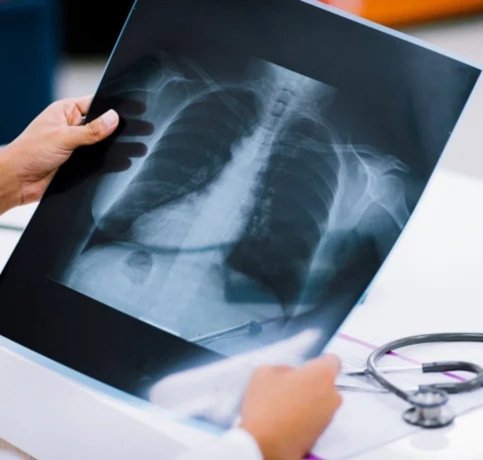 Interventional Radiology