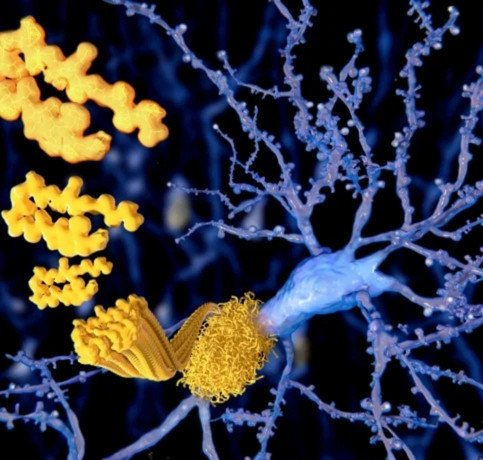Neurosurgery