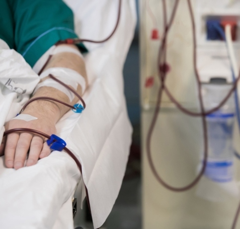 Dialysis