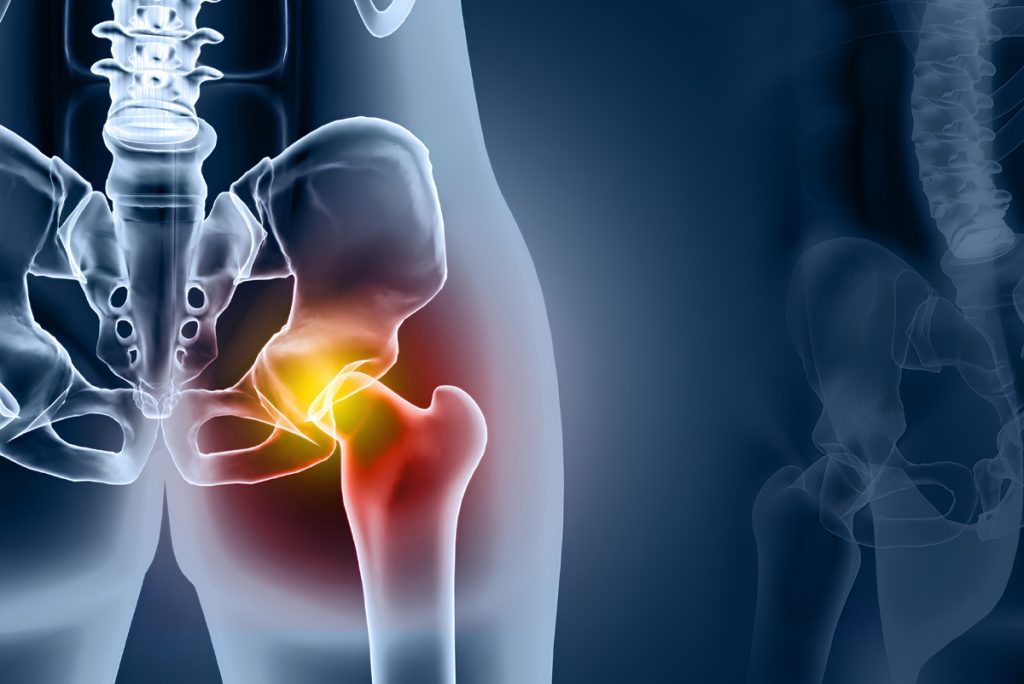 A Complete Guide to Total Hip Replacement Surgery, Recovery, and Benefits